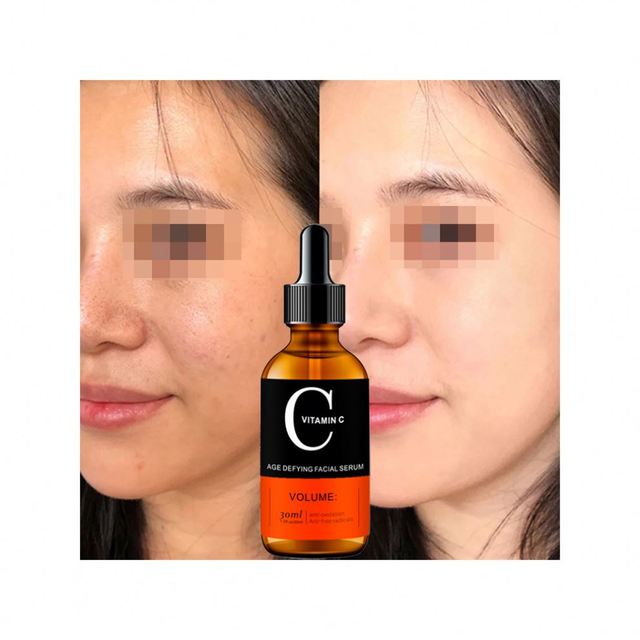 Melanin Glow: Vitamin C Brightening Serum